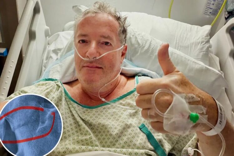 Piers Morgan hospitalized, needs hip replacement after fall, jokingly blames Trump Piers Morgan hospitalized, needs hip replacement after fall, jokingly blames Trump