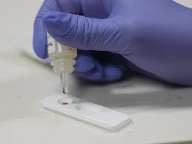 DNA from 5,500 years ago shows syphilis was rooted in the Americas before Columbus