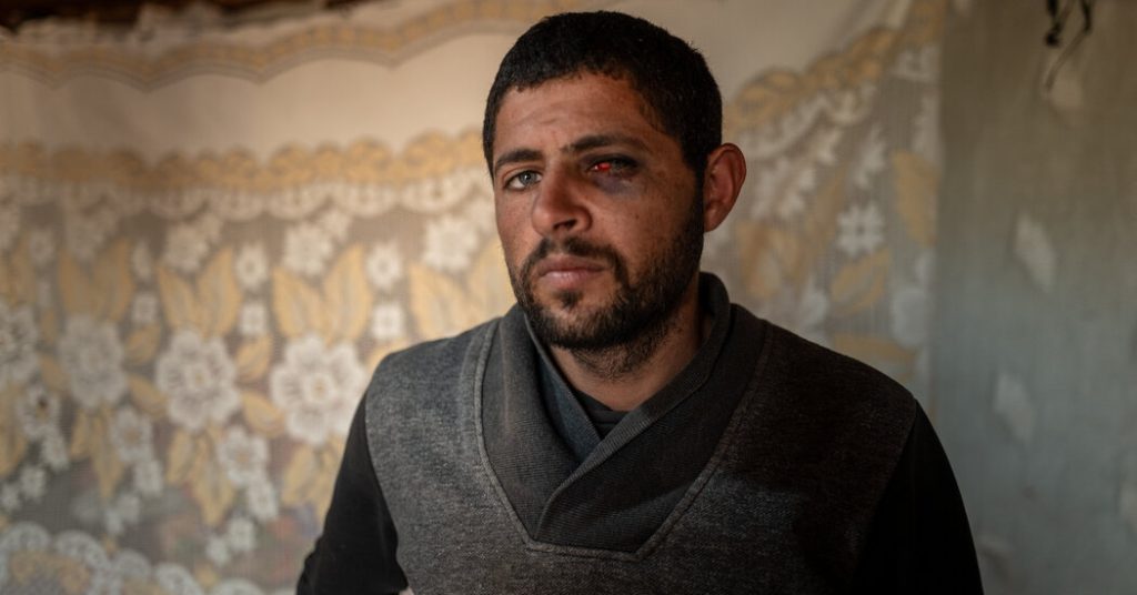 Palestinian man alleges sexual assault by Israeli settlers in Occupied West Bank