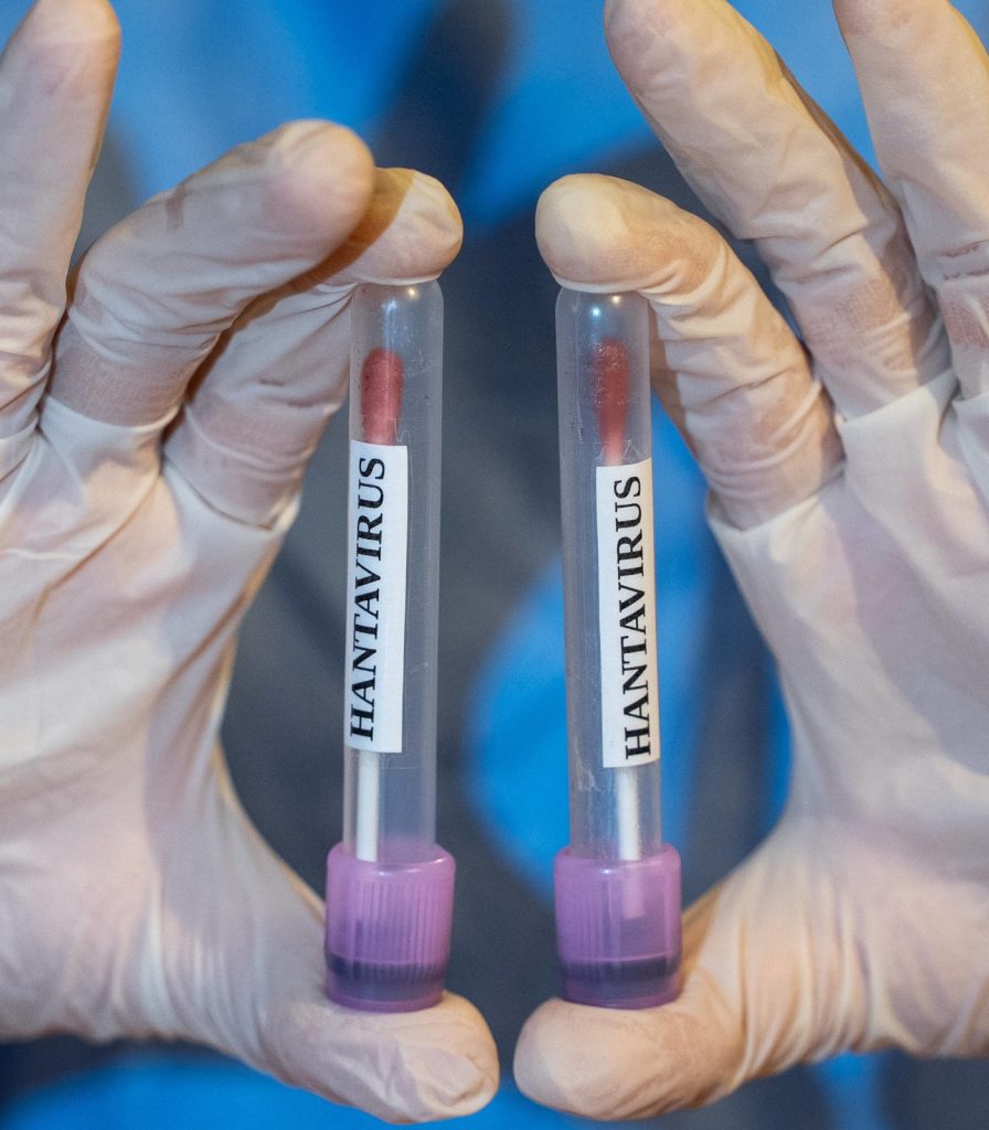 French, American passengers test positive for hantavirus after cruise evacuation French, American passengers test positive for hantavirus after cruise evacuation
