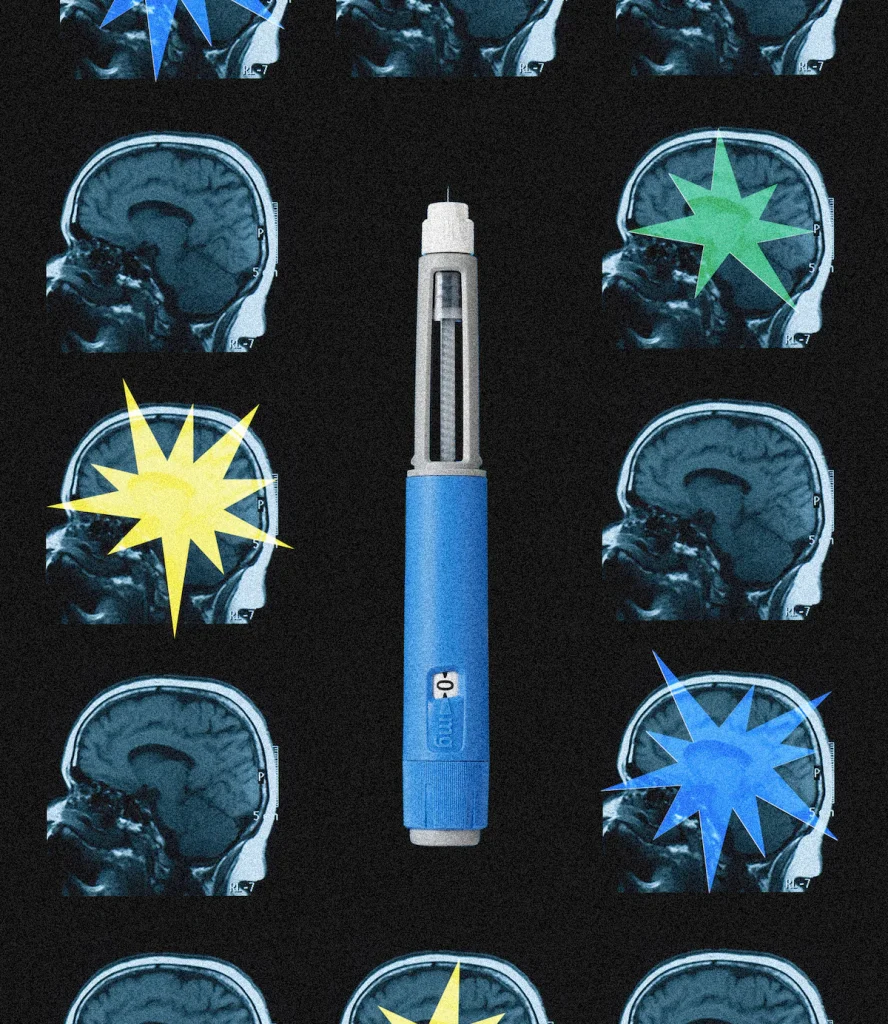 OZEMPIC may be reshaping brain, scientists say…