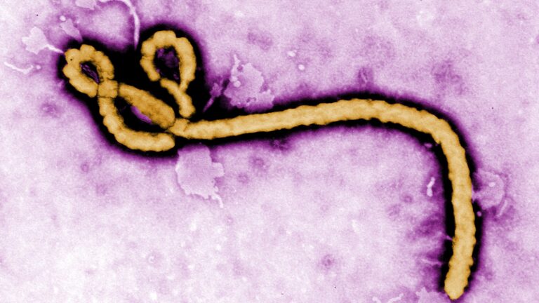 German hospital discharges American doctor cured of Ebola German hospital discharges American doctor cured of Ebola