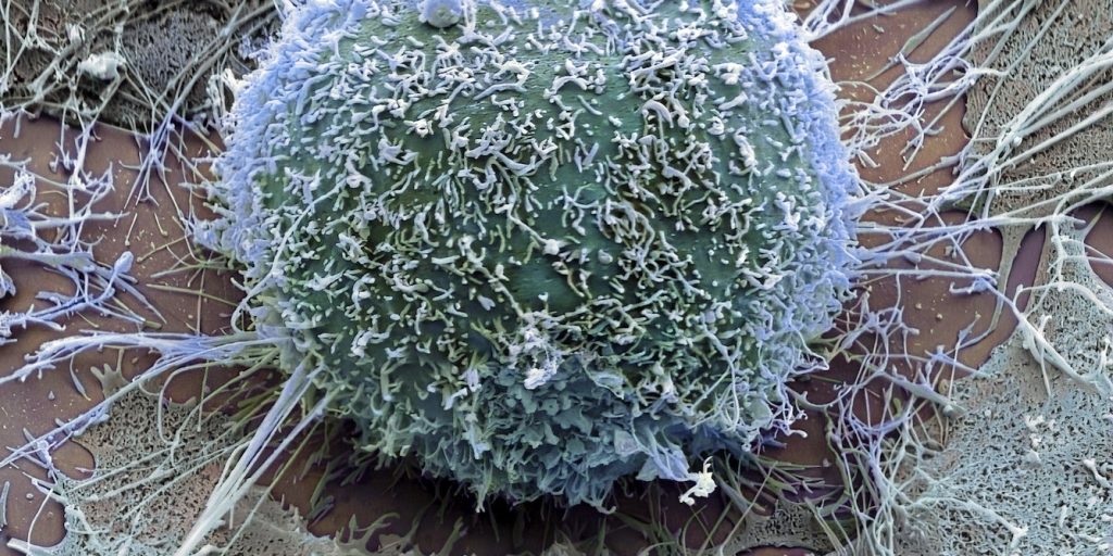 South African scientists make breakthrough in decoding cancer’s most effective survival strategy South African scientists make breakthrough in decoding cancer’s most effective survival strategy